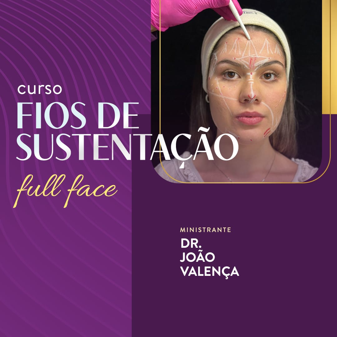 fios_de_sustentacao